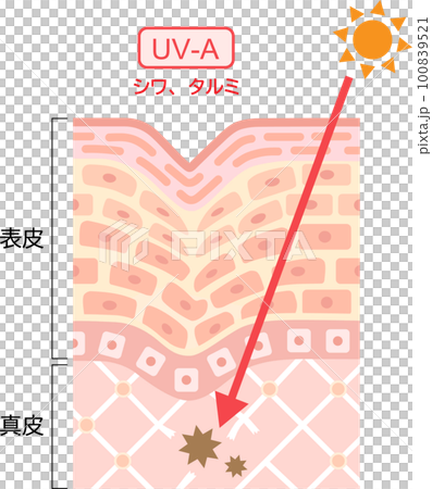 Ultraviolet rays UV-A cross section of skin 100839521