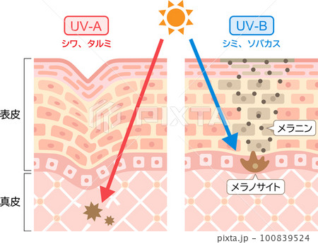 紫外線　UV-AとUV-Bの違い　肌の断面図　 100839524