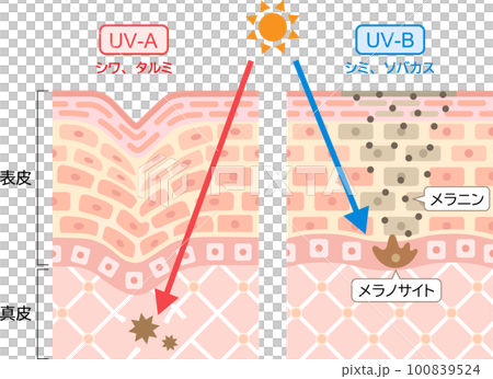 紫外線　UV-AとUV-Bの違い　肌の断面図　 100839524