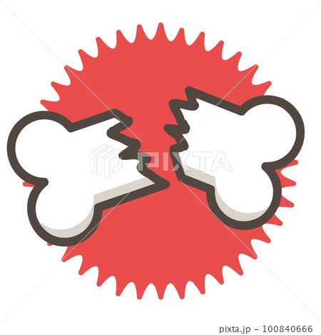 シンプルな骨折のイラスト 100840666