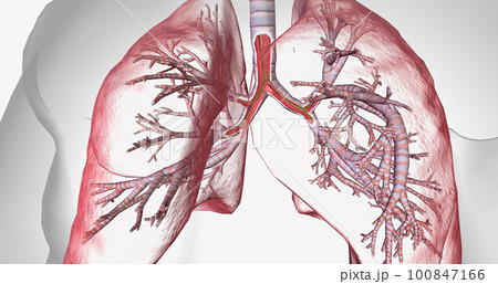 Cystic fibrosis is a genetically inherited disease that affects secretory cells throughout the body. Cystic fibrosis is a genetically inherited disease that affects secretory cells throughout the body. 100847166
