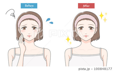 ニキビに悩む女性 ビフォーアフター ニキビに悩む女性 ビフォーアフター 100848177