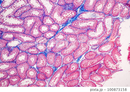 Anatomy and Histological Epididymis and Testis human cells under microscope. Anatomy and Histological Epididymis and Testis human cells under microscope. 100873158