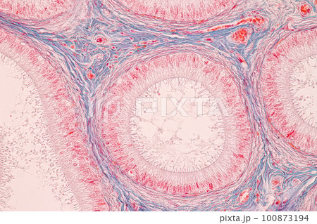 Anatomy and Histological Epididymis and Testis human cells under microscope. Anatomy and Histological Epididymis and Testis human cells under microscope. 100873194