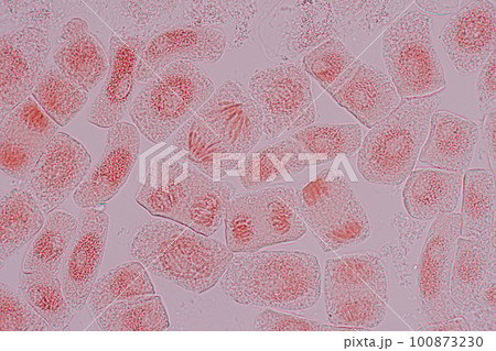 Root tip of Onion and Mitosis cell in the Root tip of Onion under a microscope. 100873230