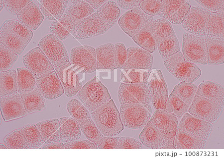 Root tip of Onion and Mitosis cell in the Root tip of Onion under a microscope. Root tip of Onion and Mitosis cell in the Root tip of Onion under a microscope. 100873231