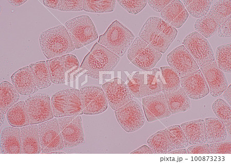 Root tip of Onion and Mitosis cell in the Root tip of Onion under a microscope. Root tip of Onion and Mitosis cell in the Root tip of Onion under a microscope. 100873233