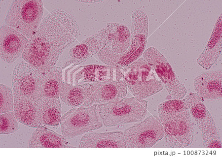 Root tip of Onion and Mitosis cell in the Root tip of Onion under a microscope. Root tip of Onion and Mitosis cell in the Root tip of Onion under a microscope. 100873249