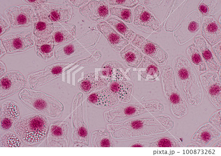 Root tip of Onion and Mitosis cell in the Root tip of Onion under a microscope. 100873262