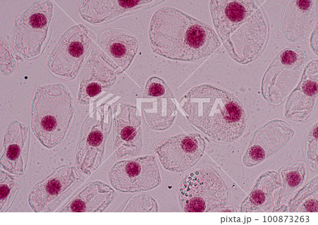 Root tip of Onion and Mitosis cell in the Root tip of Onion under a microscope. 100873263