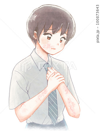 肌トラブル・全身アトピーに悩まされる学生のイラスト 肌トラブル・全身アトピーに悩まされる学生のイラスト 100873643