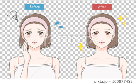 A woman who suffers from dark circles before and after 100877455