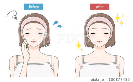 そばかすに悩む女性　ビフォーアフター　目を瞑る 100877459