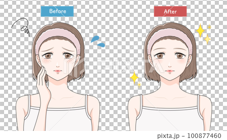 A woman suffering from freckles before and after 100877460