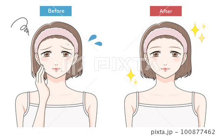 ほくろに悩む女性 ビフォーアフター ほくろに悩む女性 ビフォーアフター 100877462