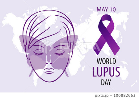 World Lupus Day, May 10, banner. Woman's face with butterfly and purple ribbon. Medical poster, vector 100882663