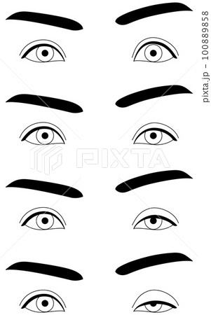 医療イラスト、眼瞼下垂の症状 正常~重症 医療イラスト、眼瞼下垂の症状 正常~重症 100889858