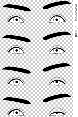 医療イラスト、眼瞼下垂の症状 正常~重症 医療イラスト、眼瞼下垂の症状 正常~重症 100889858
