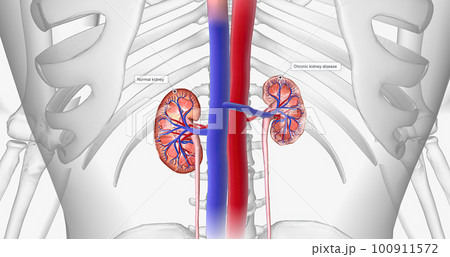 The kidneys filter waste out of the blood for the entire body. 100911572