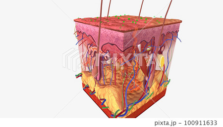 Contact Dermatitis in Skin Tissue 100911633