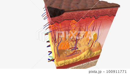 In Stage I ALM, the tumor is very small and located on the top-most layer of the skin, the epidermis. 100911771