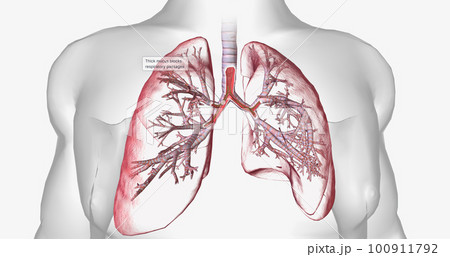 Cystic fibrosis is a genetically inherited disease that affects secretory cells throughout the body. 100911792