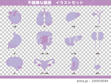 不健康器官插圖集的圖像 不健康器官插圖集的圖像 100938084