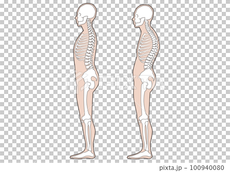 ヒューマンボディ　人体骨格　良い姿勢　悪い姿勢　カラダの歪み 100940080