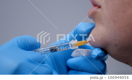 A doctor inserts painkillers into the chin area of womans face A doctor inserts painkillers into the chin area of womans face 100949058