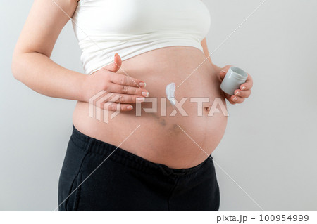 Pregnant woman applying white cream on the belly with bruises from injections taking care of skin 100954999