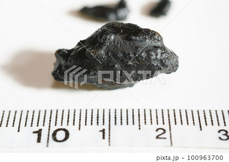 黒い胆石とメジャー 黒い胆石とメジャー 100963700