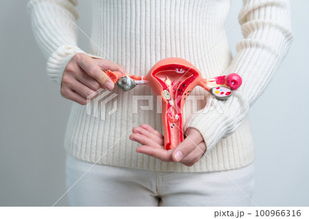 Woman holding Uterus and Ovaries model. Ovarian and Cervical cancer, Cervix disorder, Endometriosis, Hysterectomy, Uterine fibroids, Reproductive system and Pregnancy concept 100966316