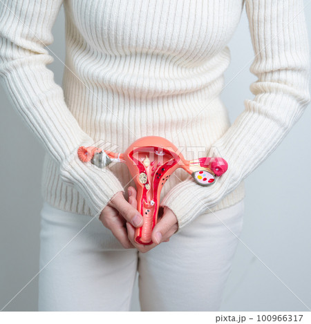 Woman holding Uterus and Ovaries model. Ovarian and Cervical cancer, Cervix disorder, Endometriosis, Hysterectomy, Uterine fibroids, Reproductive system and Pregnancy concept Woman holding Uterus and Ovaries model. Ovarian and Cervical cancer, Cervix disorder, Endometriosis, Hysterectomy, Uterine fibroids, Reproductive system and Pregnancy concept 100966317