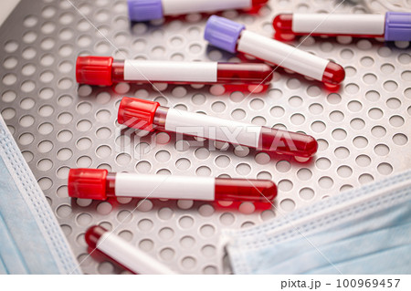 Test tubes with blood samples 100969457