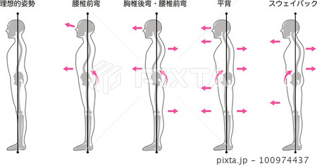 立ち姿勢評価分類 100974437