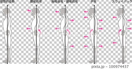 Standing posture evaluation classification 100974437