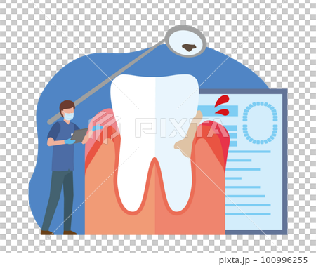 歯周病の歯と歯科医師 100996255