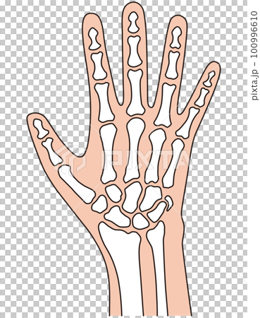 手の骨格　医療　ケガ　人体模型 100996610