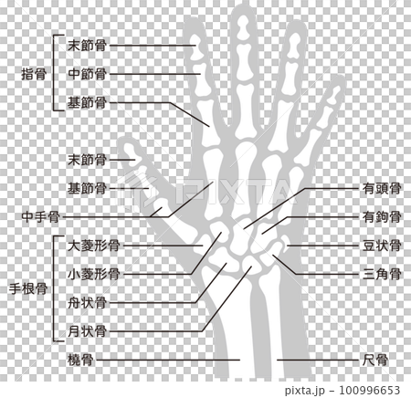 Hand skeleton medical injury human body model Hand skeleton medical injury human body model 100996653