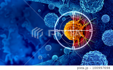 Cancer Detection 100997698