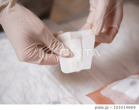 Close-up of the replacement of a sterile patch by a nurse with a glove on a patient's knee after surgery 101014669