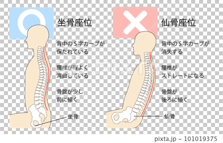 坐骨座りと仙骨座りの姿勢の比較イラスト 坐骨座りと仙骨座りの姿勢の比較イラスト 101019375