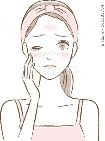 日焼け・赤ら顔・ヒリヒリなどの肌荒れに悩む若い女性のイラスト 101035704