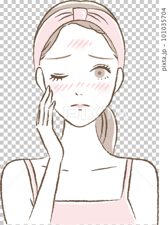 日焼け・赤ら顔・ヒリヒリなどの肌荒れに悩む若い女性のイラスト 101035704