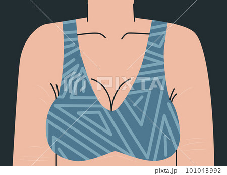 Big female bust in bra. Woman's body with stretch marks on her arms and chest. Upper female body in geometric print top. Vector trend illustration for design. 101043992