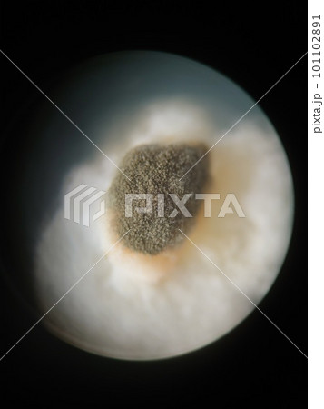 米に生えたカビの顕微鏡写真 101102891