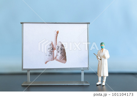 Miniature people. A doctor examines pneumonia in the picture, a respiratory disease. Miniature people. A doctor examines pneumonia in the picture, a respiratory disease. 101104173
