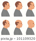Hair loss stages vector isolated. Male alopecia. Set of balding process. Hairless man heads side view. 101109320
