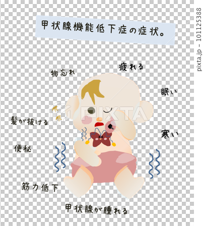 甲狀腺功能減退症症狀說明 101125388