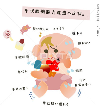甲状腺機能亢進症　症状イラス 101125389